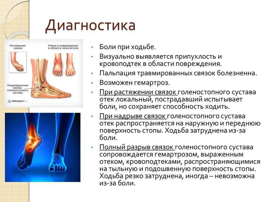 Упражнения для пожилых людей при артрозе коленных суставов