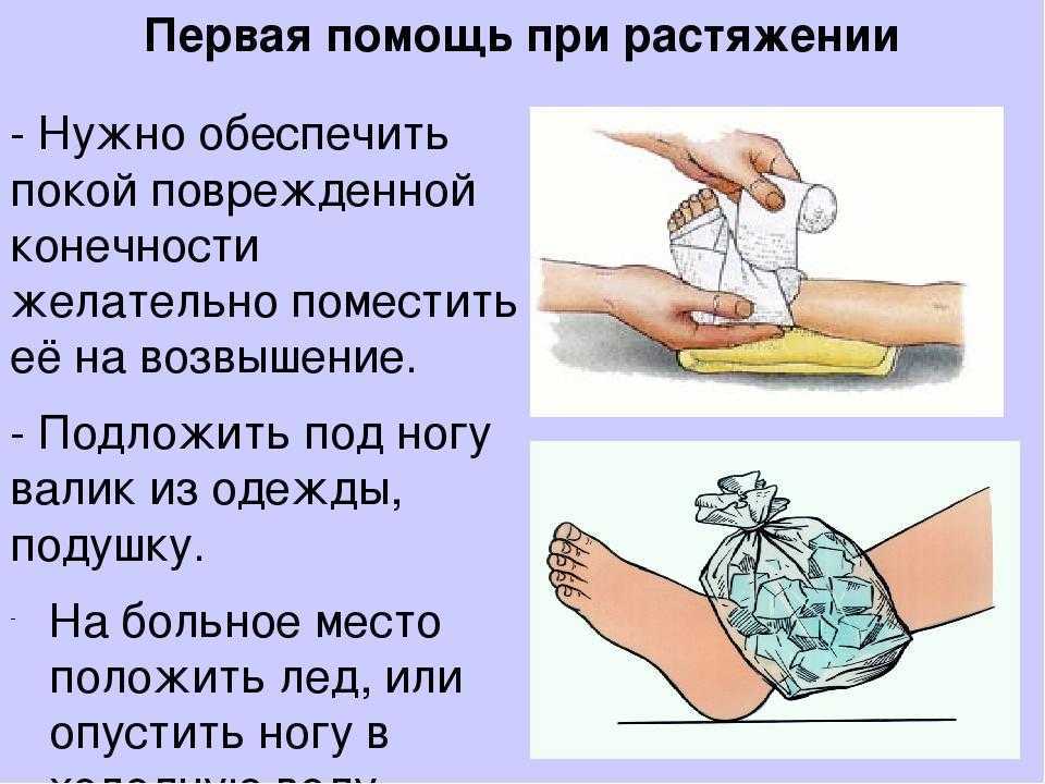 Ушиб тазобедренного сустава