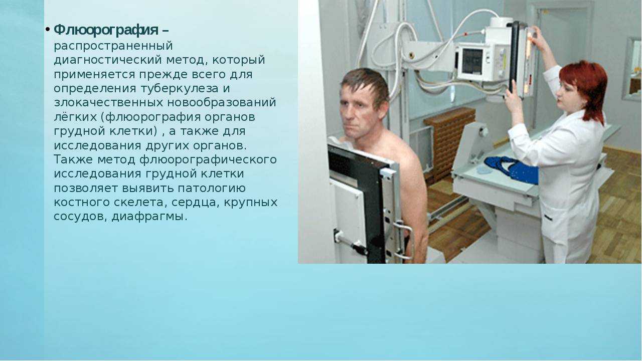 Внебольничная пневмония