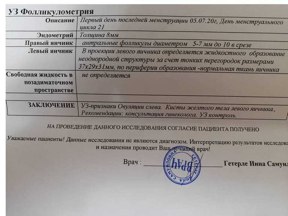 Мультифолликулярные яичники