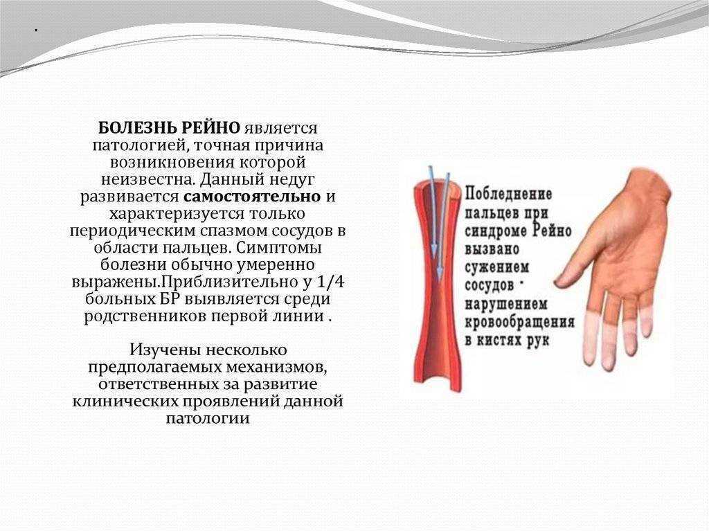 Смерть от атеросклероза сосудов. как этого избежать?