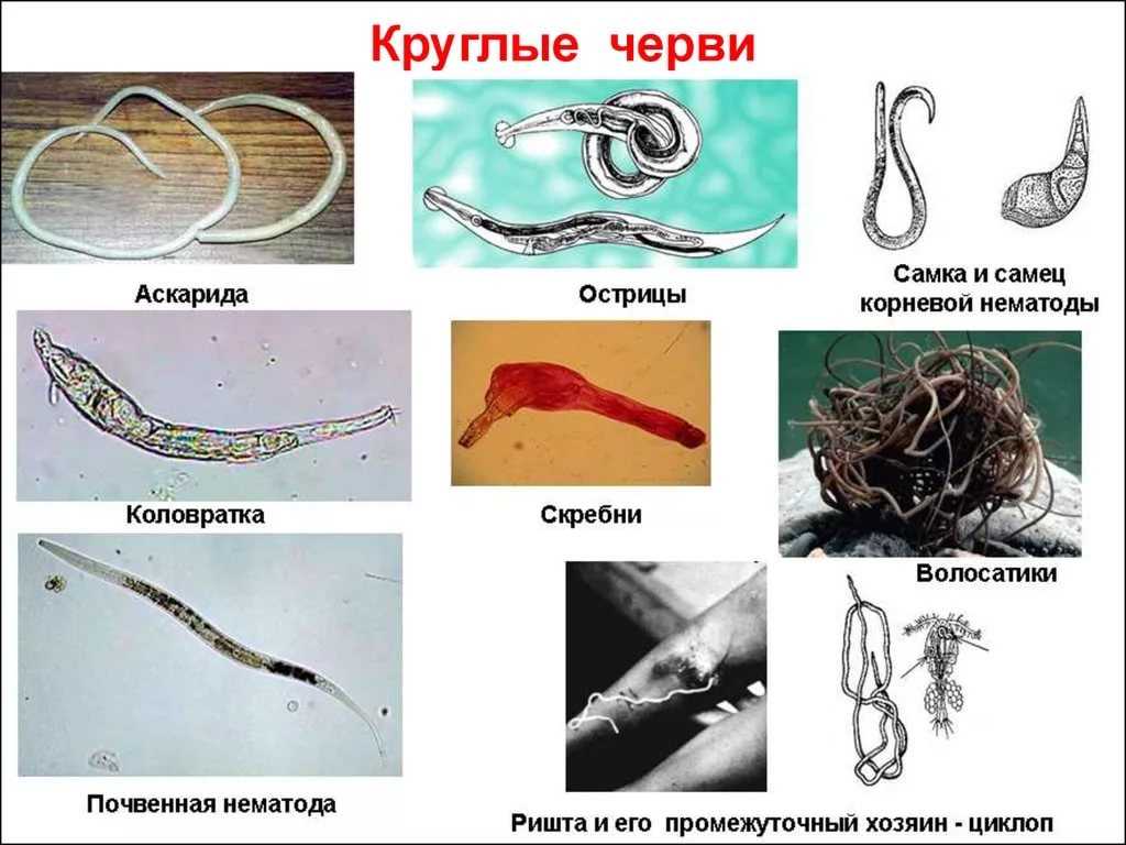 ? как избавиться от глистов? ~?глистная инвазия?