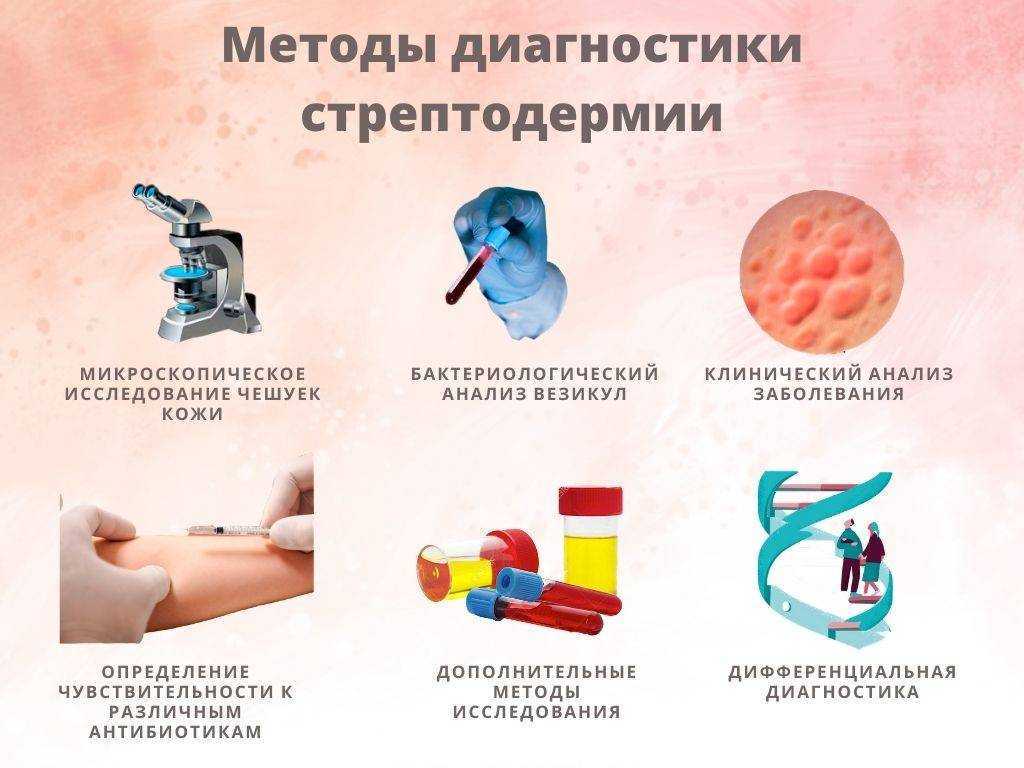 Пиодермия