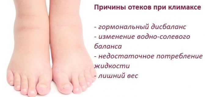 Миокардит
