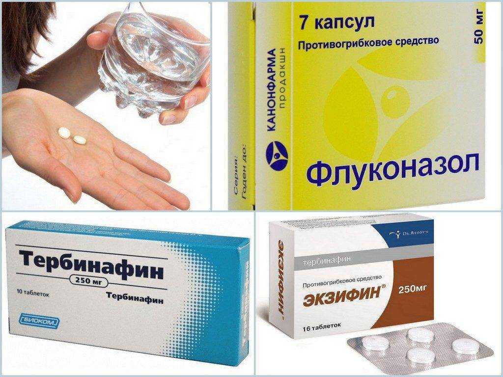 Лечение экземы на ногах