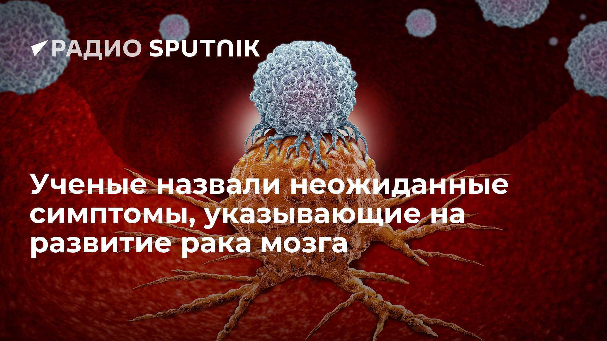 Сосудистые заболевания головного мозга