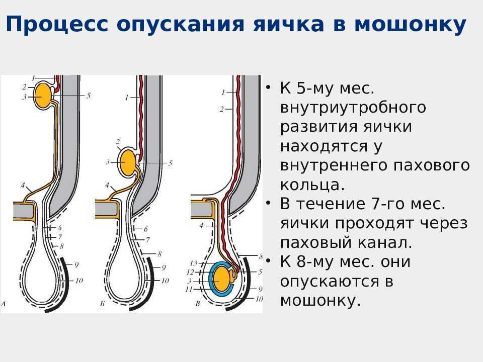 Болезни яичек. характерные симптомы. причины возникновения