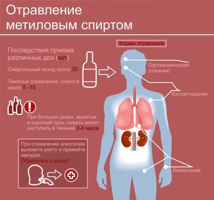 Отравление суррогатами алкоголя