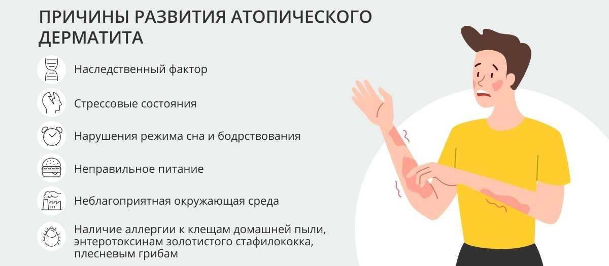 Нейродермит