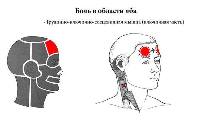 Почему может болеть голова у ребенка?