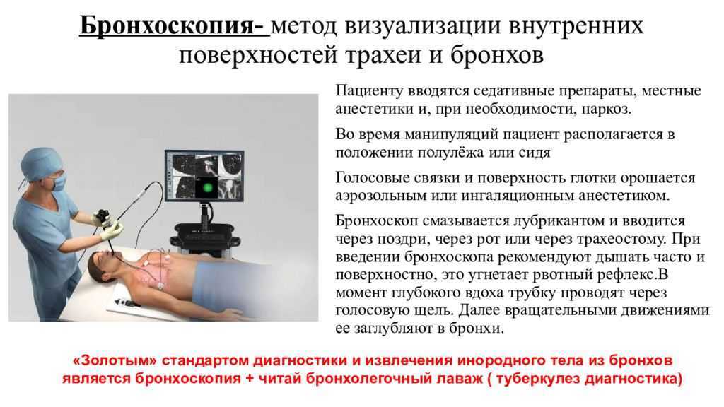 Бронхоскопия - показания, противопоказания