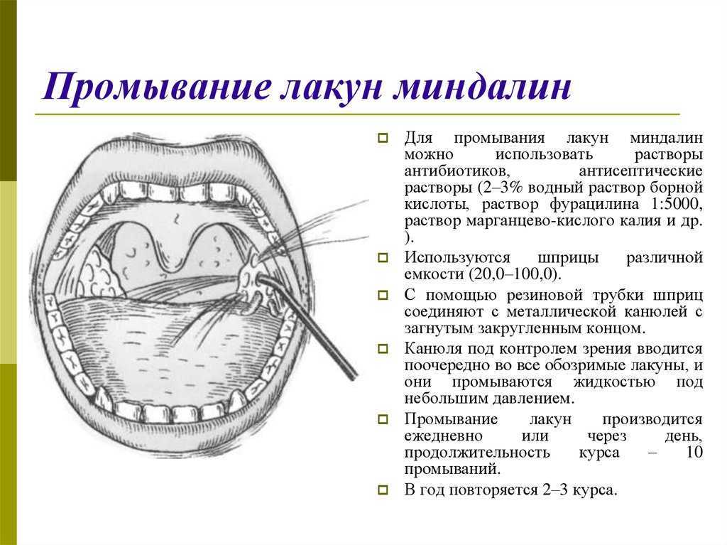 Соленый привкус во рту: причины. почему во рту вкус соли: причины у женщин, мужчин
