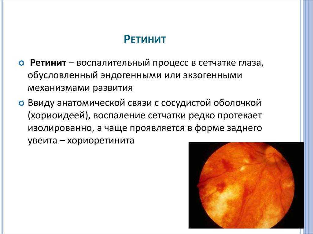 Особенности восприятия человека. зрение | fernflower group