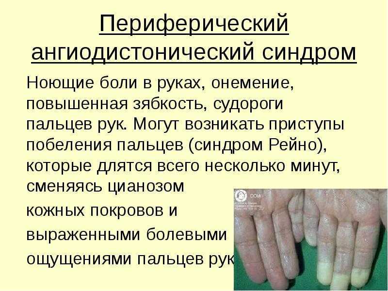 Теория стресса
