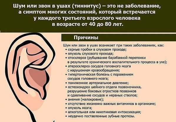 Шум в ушах (шум в голове)