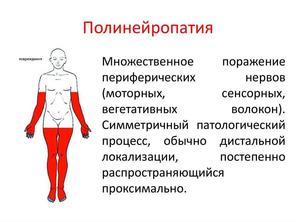 Кто такой невролог - что лечит, проверяет и смотрит невропатолог