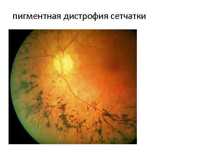 Мир слепых: что видят незрячие люди? | научно популярный журнал sciencepop
