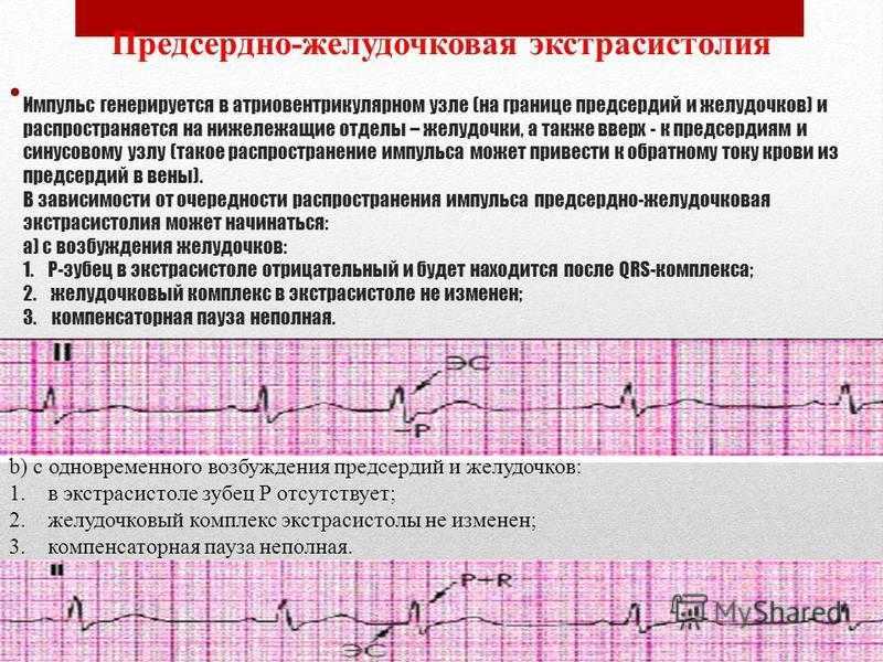 Сердечно-сосудистые заболевания: классификация, симптомы, диагностика