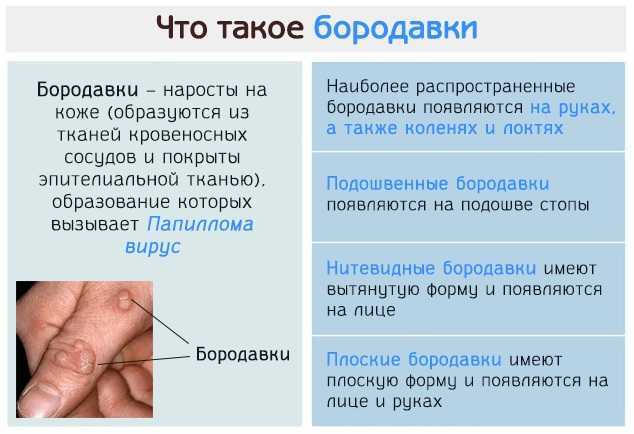 Папилломы на лице - причины, симптомы, диагностика, лечение и профилактика