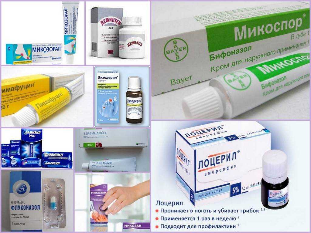 Микроспория (стригущий лишай) кожи и ногтей у детей и взрослых - возбудители инфекции, пути заражения, симптомы, лечение и профилактика, фото