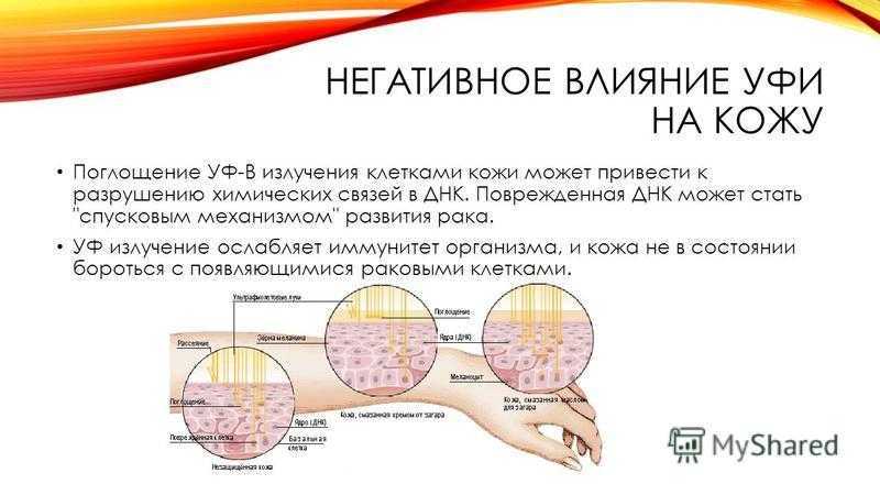 Можно ли загорать при акне?