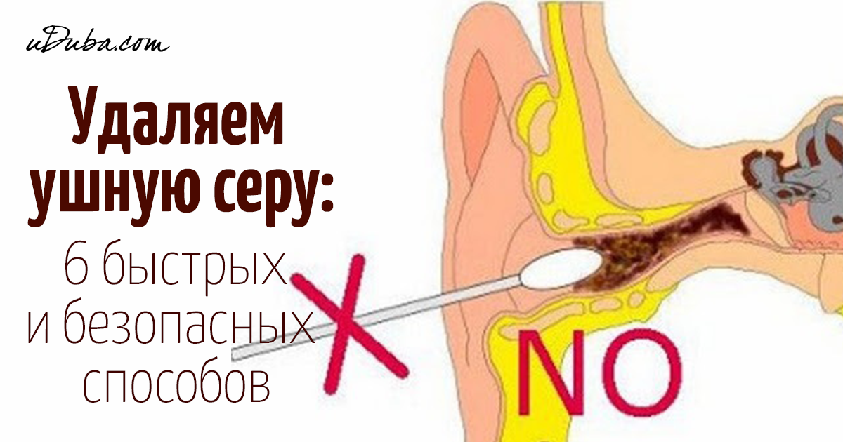 Нужно ли чистить уши грудничку?