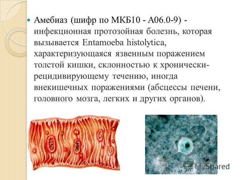 Энцефалопатия