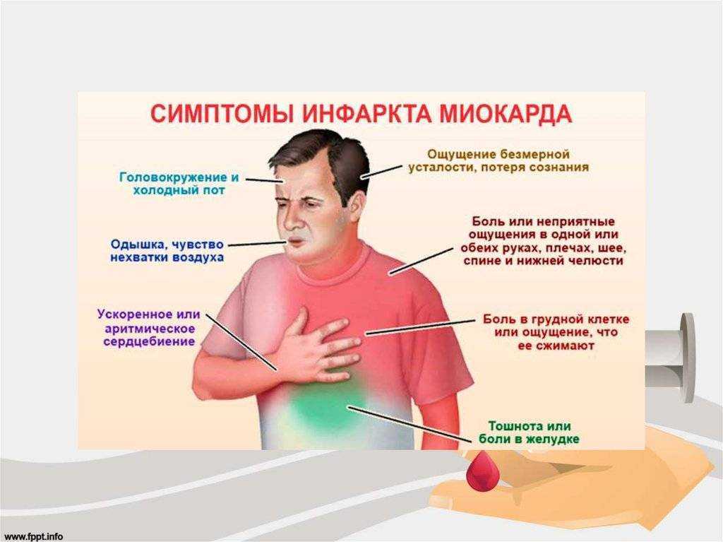 Инфаркт миокарда: как выглядит, что значит инфаркт сердца