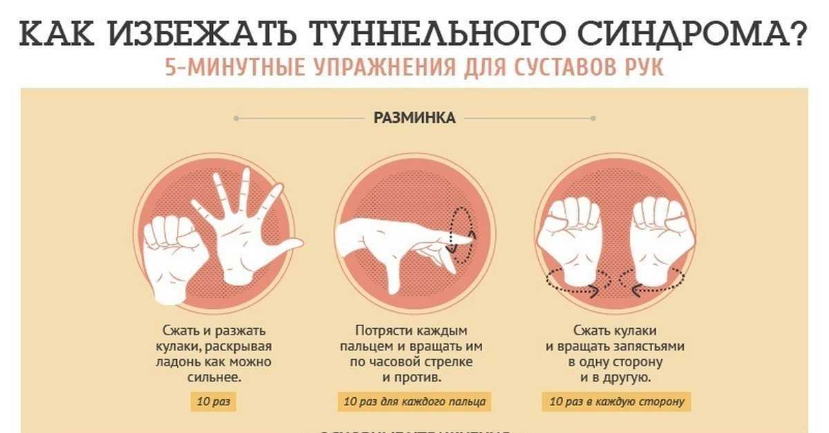Синдром запястного канала