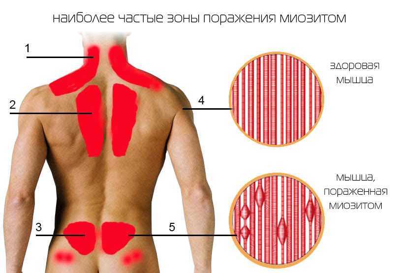 Почему болит спина