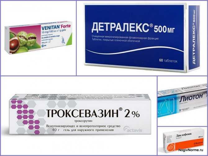 Склеротерапия вен нижних конечностей – отличный метод для избавления от сосудистых звездочек! операция склеротерапия показана пациентам с сосудитсыми звездочками и варикозом!