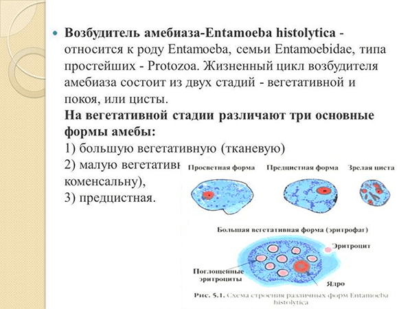 Амебиаз