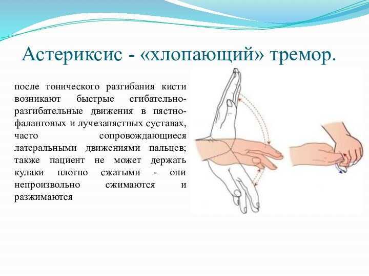 Болезнь или синдром шегрена: диагностика, симптомы и лечение.