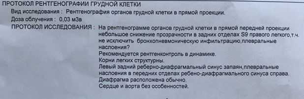 Жидкость в плевральной полости – диагностика и лечение