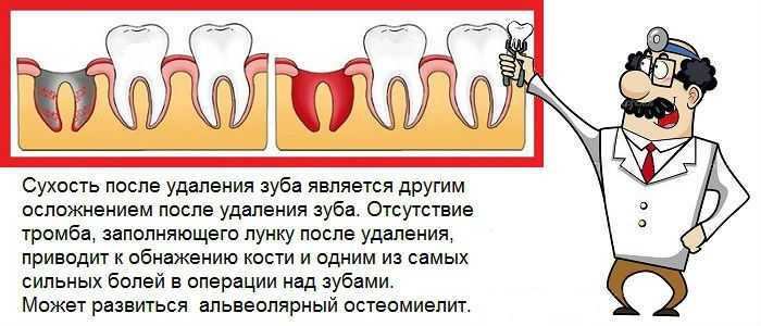 Топ-10 рекомендаций после удаления зуба