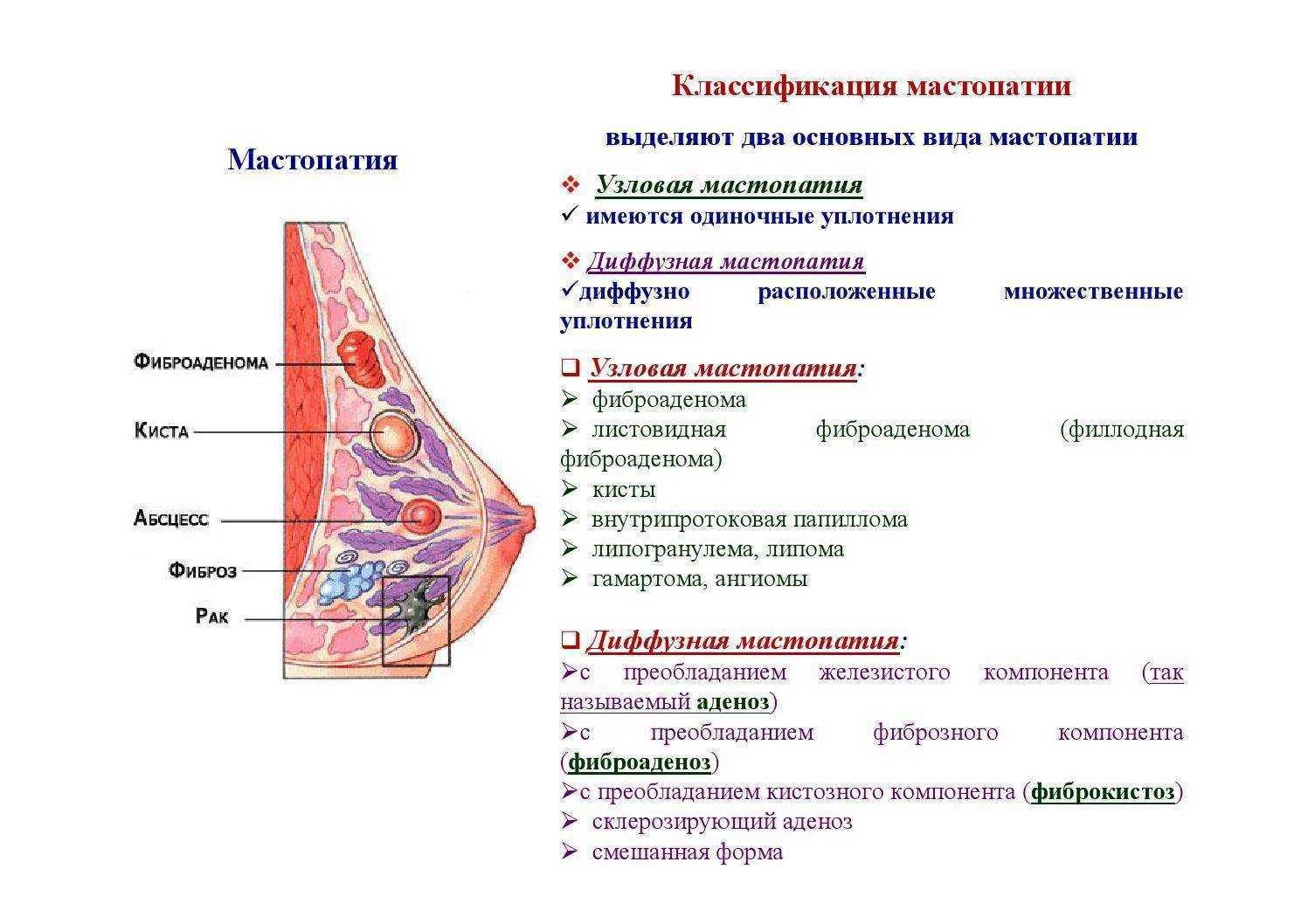 Мастопатия - причины, симптомы, диагностика, лечение и профилактика