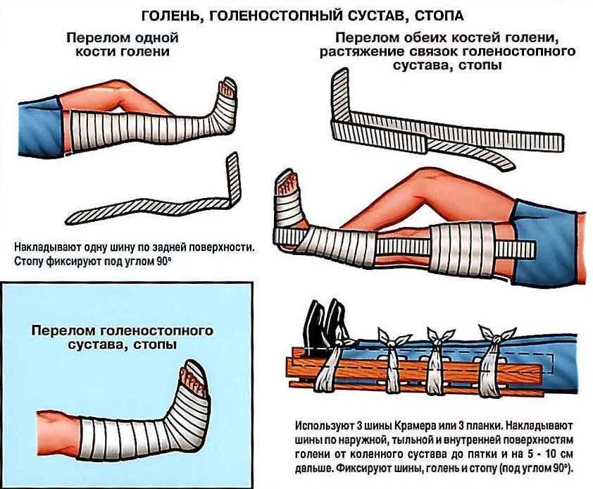 Замедленно консолидирующиеся переломы