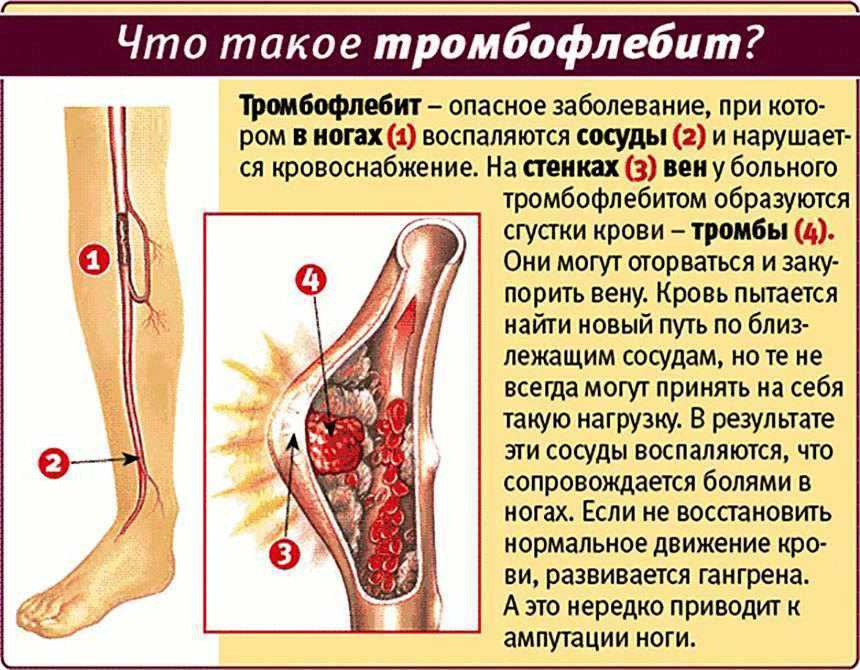 Фарматека » тромбоз воротной вены в практике гастроэнтеролога