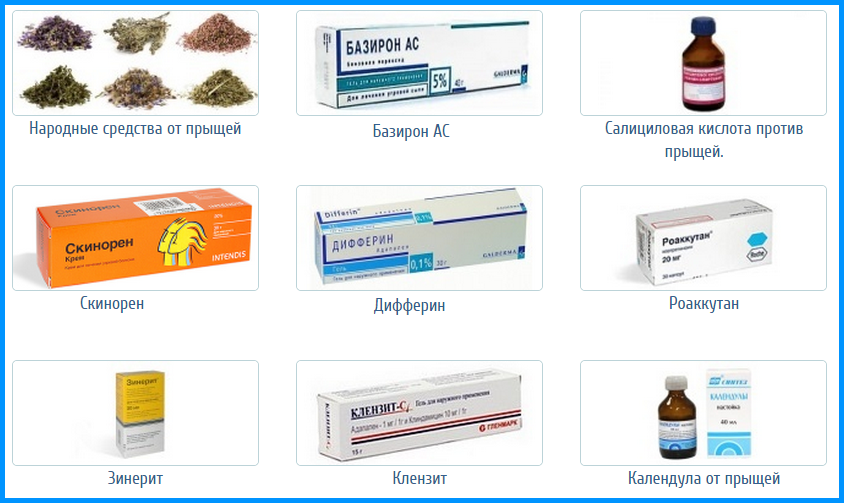 Киста яичника: как выявить и вылечить опасное образование
