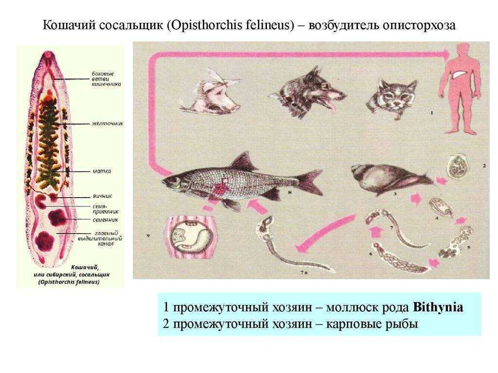 Описторхоз