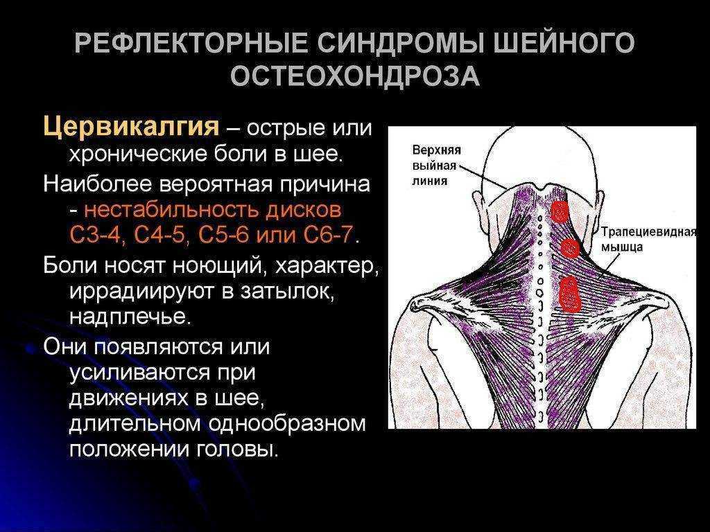 Мышечный тонус, спазм мышц шеи