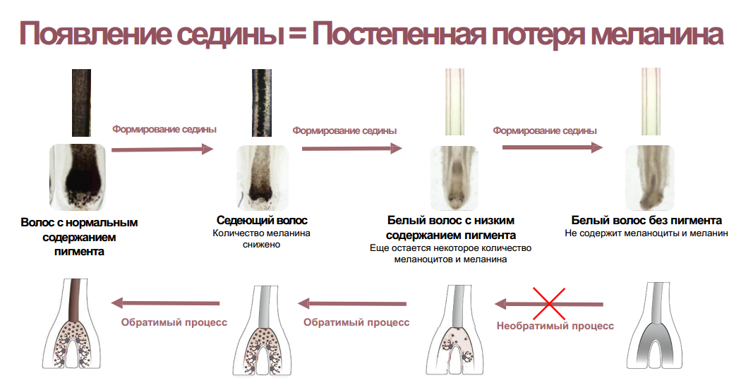 Как снег на голову: почему седеют волосы в раннем возрасте?