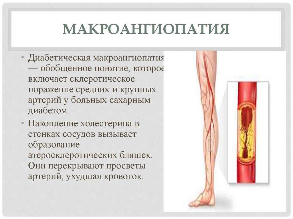 Коронавирус и сосуды