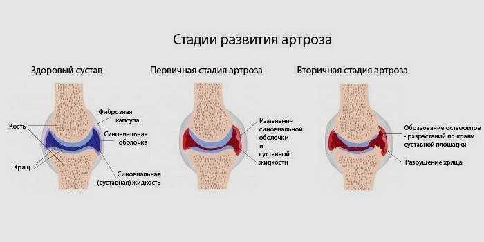 Факторы риска развития рака