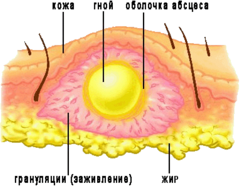 Бугорки и уплотнения на половых органах