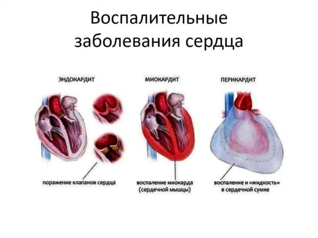 Рентгенография брюшной полости