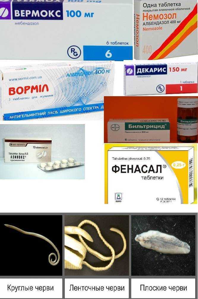 Энтеробиоз