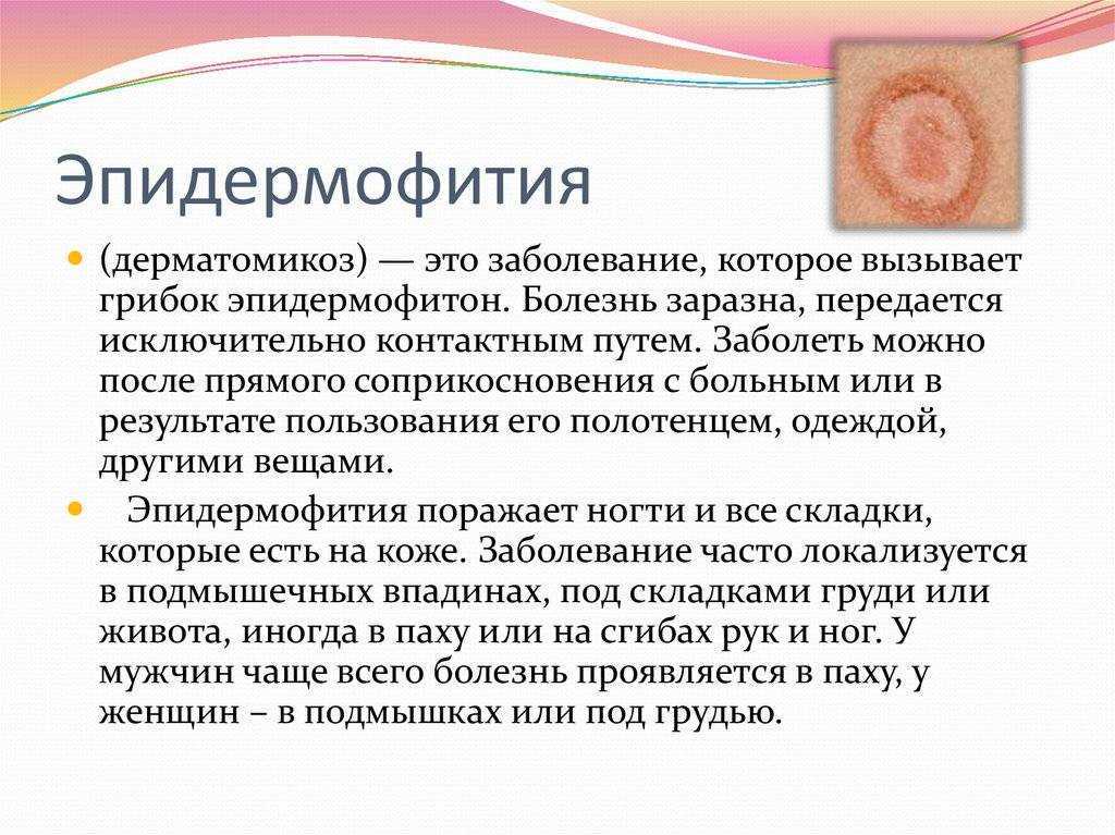Кожа