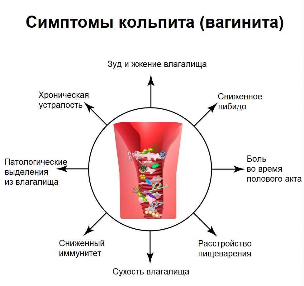 Молочница (кандидоз) у мужчин и женщин — подробности болезни