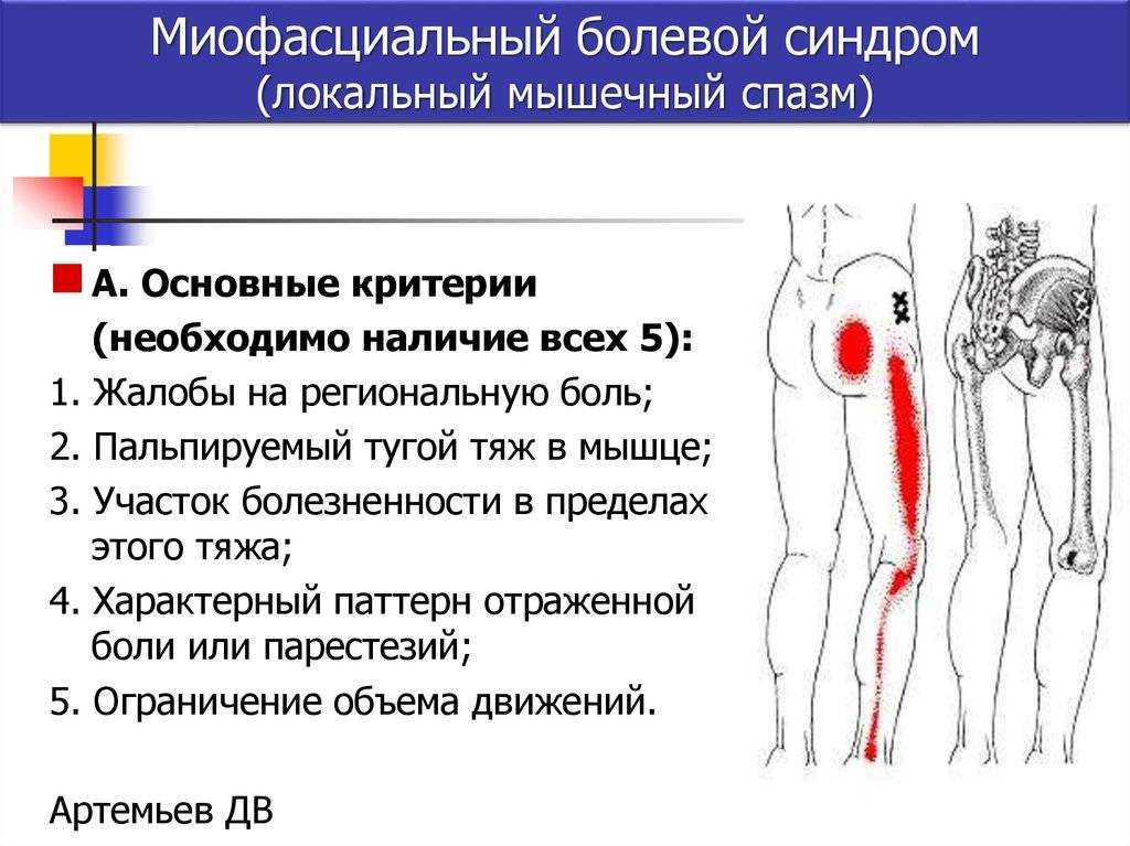 Ревматическая полимиалгия!